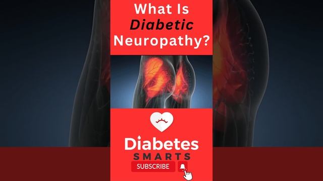 What Is Diabetic Neuropathy?