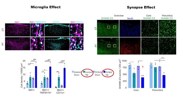 Brain Conference Poster Presentation: Nuclear Calcium Signalling Supresses Microglia During TBI