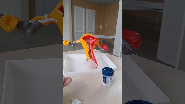 ПАП ТЕСТ класичний на склі чи РІДИННА  ЦИТОЛОГІЯ