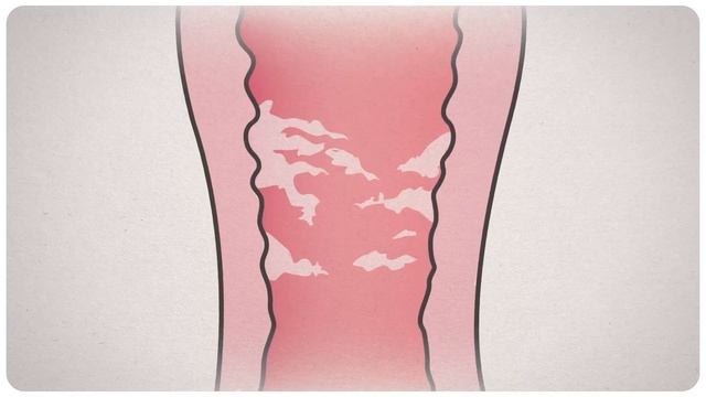 Zestica Conception Kit - Educational Medical Animation Glasgow смотреть онлайн