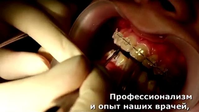 Детская стоматология - Мы создаем улыбку смотреть онлайн
