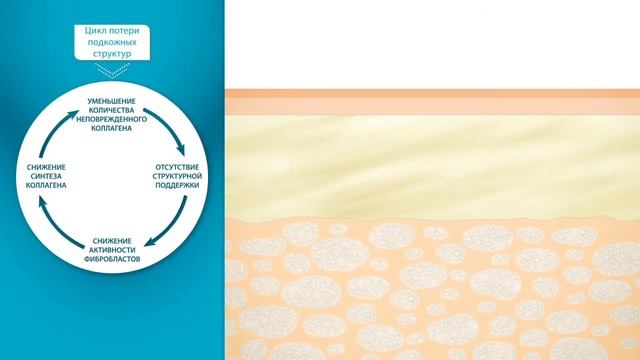 Radiesse Механизм действия смотреть онлайн