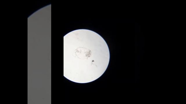 Rotifer🔮 | Zooplankton | Under Microscope 🔬 🔬| Asplanchna Gosse |