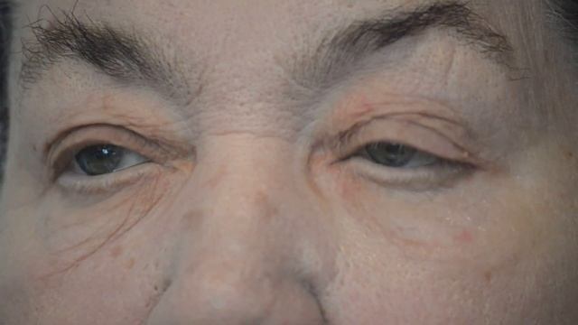 Nurani Anti Wrinkle Serum Demo 1 смотреть онлайн