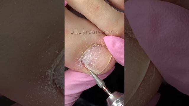 Обработка пальчиков фрезой капля 40 #педикюр #аппаратныйманикюр # #nails #nailtreatment #pedicure