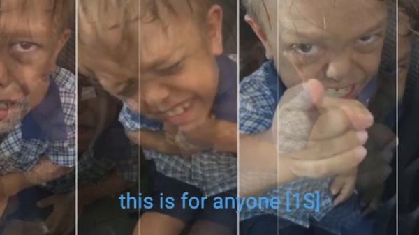 Quaden Bayles GoFundMe for bullied Australian boy raises nearly $200,000 || Quaden Bayles QuadenBay