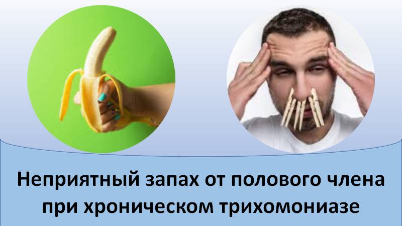 Запах от полового члена при хроническом трихомониазе смотреть онлайн