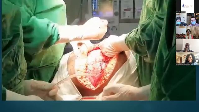 Multidisciplinary Tumour Board on "Ovarian Cancer"-An initiative of MGH,USA&Oncology Club,Banglades смотреть онлайн