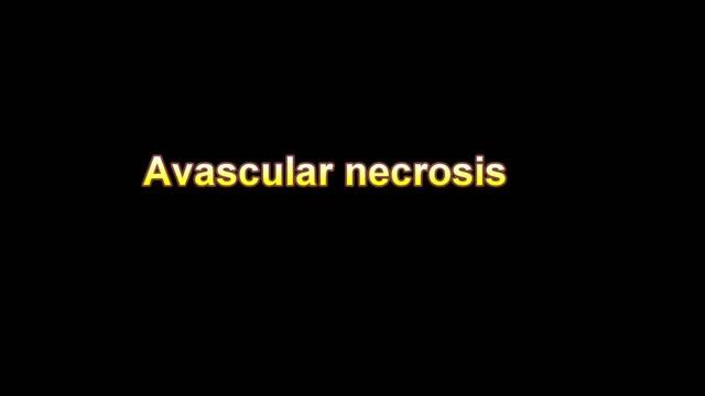 What Is The Definition Of Avascular Necrosis Medical Dictionary Free Online