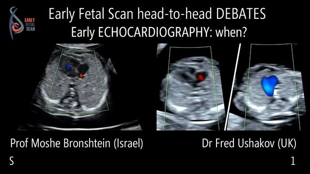 Early Fetal Scan Conference 2019 Debates: Prof  Bronshtein vs Dr Ushakov