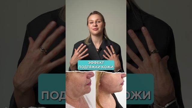 Вся ПРАВДА про смас-лифтинг! #омоложение #процедуры #смаслифтинг смотреть онлайн