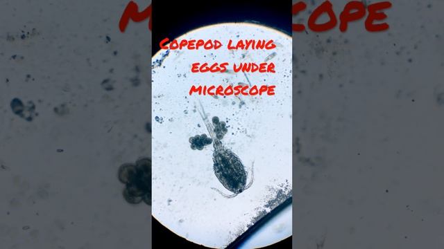 Copepod laying eggs under microscope смотреть онлайн