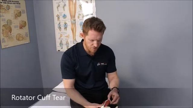 Rotator Cuff Tears