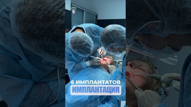 Установка 6 имплантатов. Installation of 6 implants. смотреть онлайн