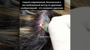 Лазерное удаление папилломы на голове