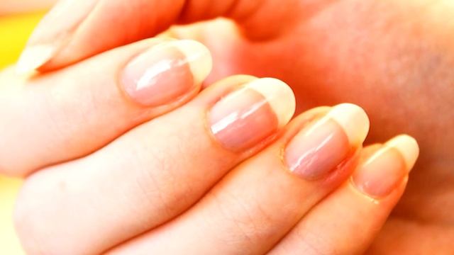 NAIL PROBLEMS ? EAT THIS ! Dr. Mandell смотреть онлайн
