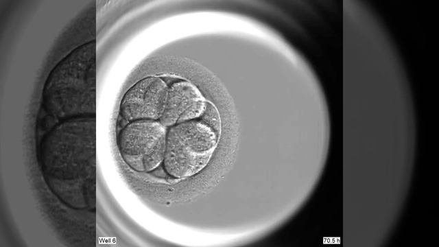 División celular en Embryoscope смотреть онлайн
