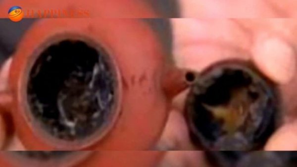 Шлаки и токсины.