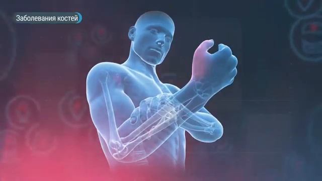 Многие не знают. Кости и суставы. смотреть онлайн