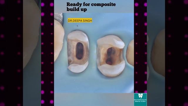 TOOTH TRANSFORMATION смотреть онлайн