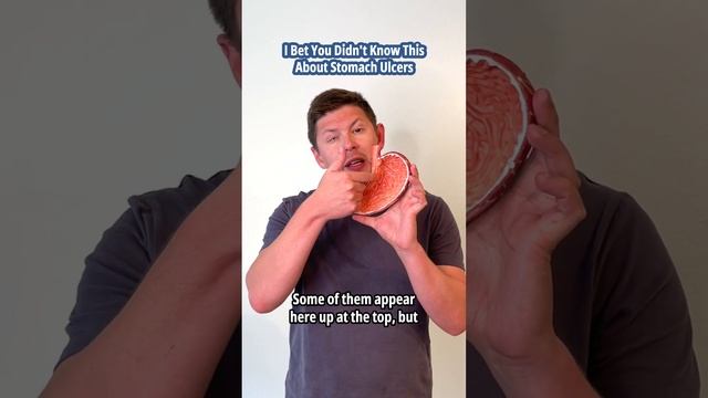 I Bet You Didn't Know This About Stomach Ulcers смотреть онлайн