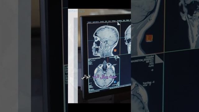 الدماغ : ماء وكهرباء والباقي افكار ! смотреть онлайн
