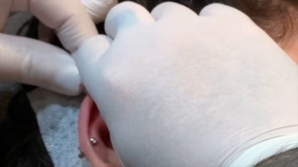 Orbital Piercing Procedure