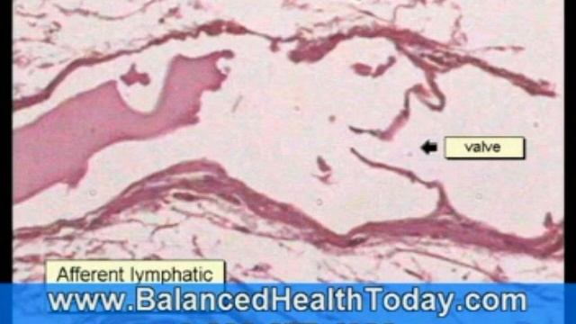 3 Microcirculation смотреть онлайн