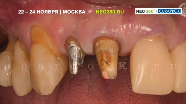 Клинический случай Рикардо Керна смотреть онлайн