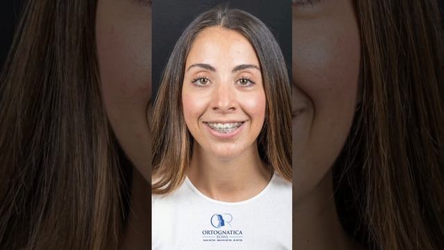 Asimmetria facciale. I nostri casi смотреть онлайн