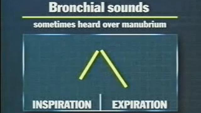 Звуки при аускультации легких breath Sounds mp4 смотреть онлайн