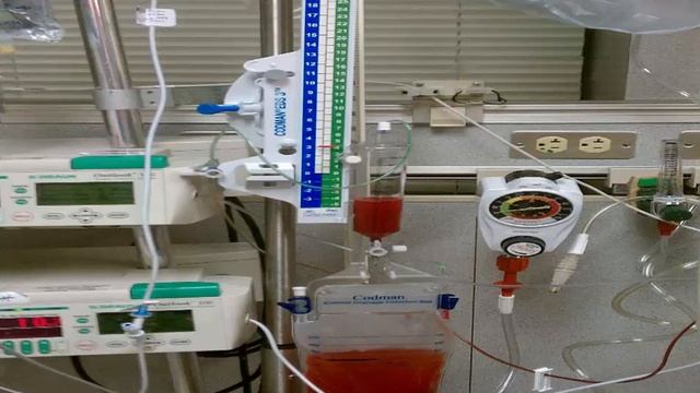 Neuro - Critical Care смотреть онлайн