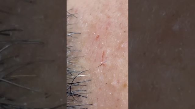 شعر تحت ااجلد