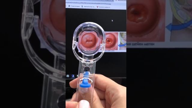 Как проводится осмотр шейки матки ?