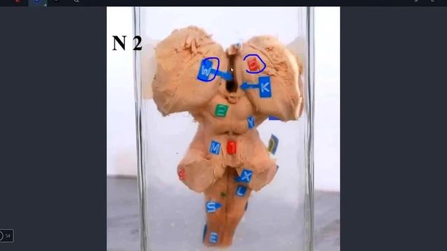 Osce Neuro-Anatomy (part 1) смотреть онлайн
