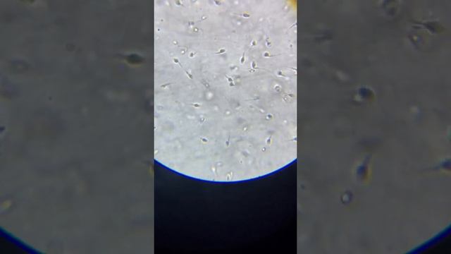 My Sperm Magnified at 900x