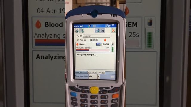 epoc 혈액가스분석기 смотреть онлайн