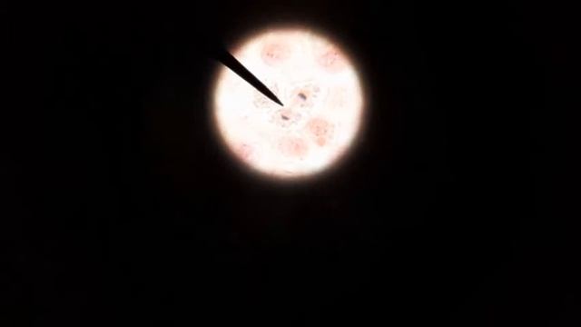 Whitefish mitosis telophase 400x and 1000x magnification смотреть онлайн