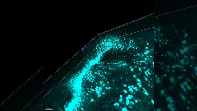 Mouse brain neuron tracing2 смотреть онлайн