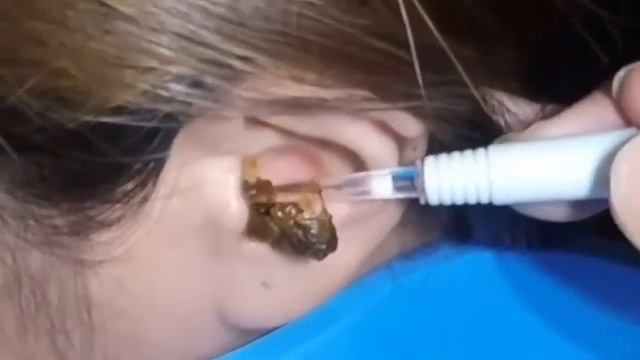 QULOQLARNI UY SHAROITIDA YUVISH.100 FOIZ ISHONCHLI смотреть онлайн