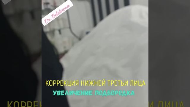 Увеличение подбородка. Коррекция нижней третьи лица смотреть онлайн