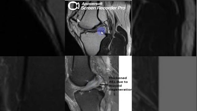 Quiz In English Case 57