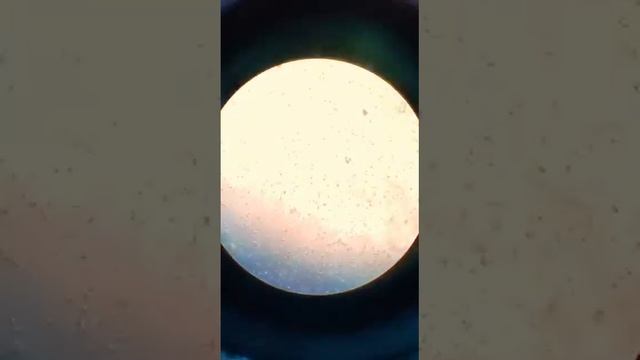 sperm count under microscope смотреть онлайн