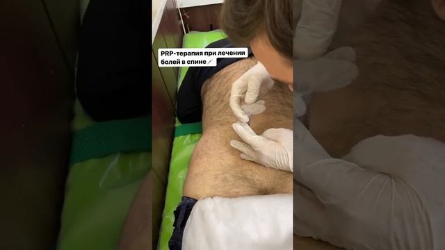 Невролог – альголог. Шихалиев Ибрагим Арсенович. смотреть онлайн