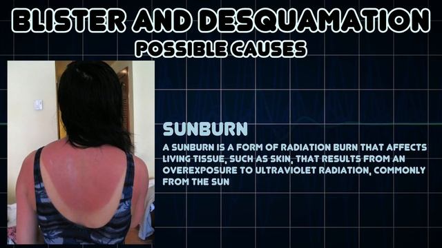 Blister and Desquamation (Medical Symptom) смотреть онлайн