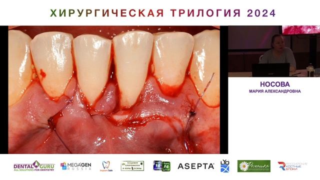 Курс Носовой Марии Александровны. Хирургическая трилогия 2024. Часть 30 смотреть онлайн