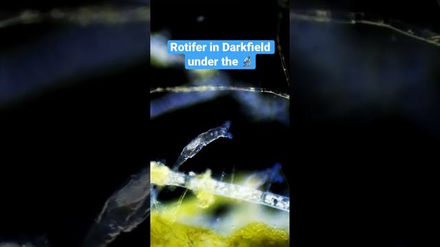 Rotifer in darkfield microscopy смотреть онлайн