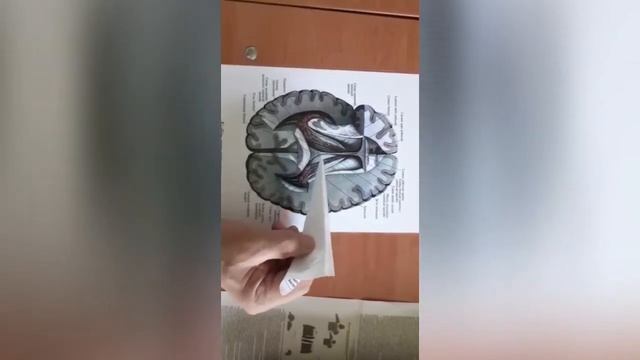Үлке мидың ақ заты. Сүйелді дене, күмбез. Базалды ядролар. Бүйір қарыншалар. смотреть онлайн