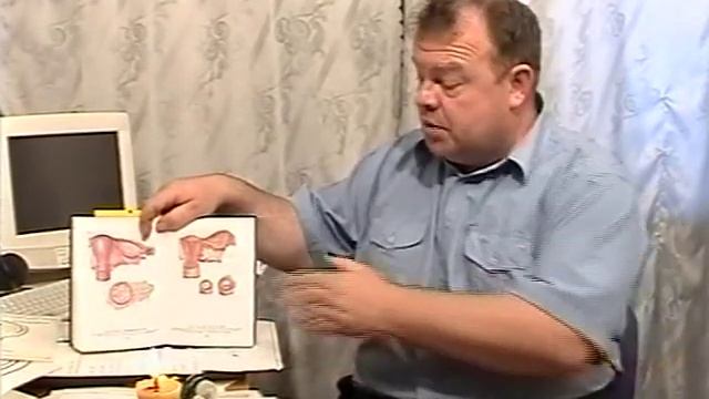 Молочница, кистозы и эрозии. Спецтехнологии помощи. смотреть онлайн