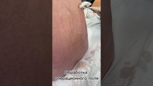 О спинальной анестезии